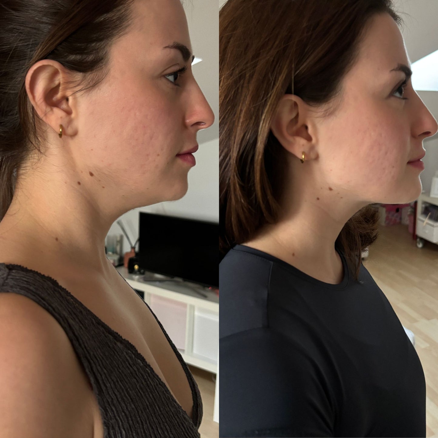 Masajeador de Cuello Profesional