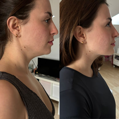 Masajeador de Cuello Profesional